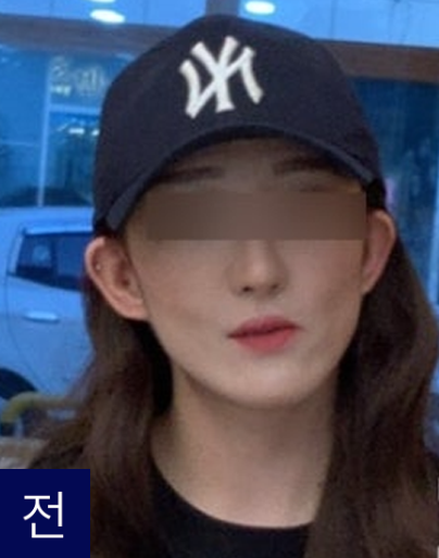 첫번째