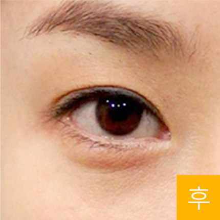 두번째