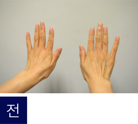 첫번째